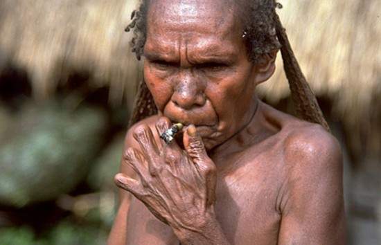 印度尼西亚部落Dani tribe断指习俗 失去一个亲人切掉一节手指头