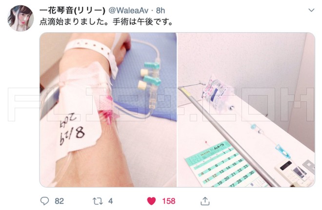 抗癌！一花琴音今天动手术