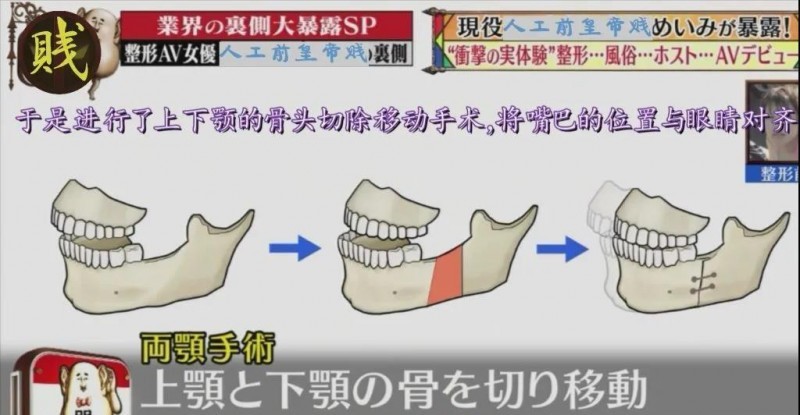 乌鸡变凤凰？高嶋明实整容上位搏成功，走上人生巅峰？