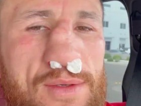 梅拉布·德瓦利什维利鼻骨两处骨折仍要打!放话硬刚亨利·塞胡多,大发体育助力你的致富之路!